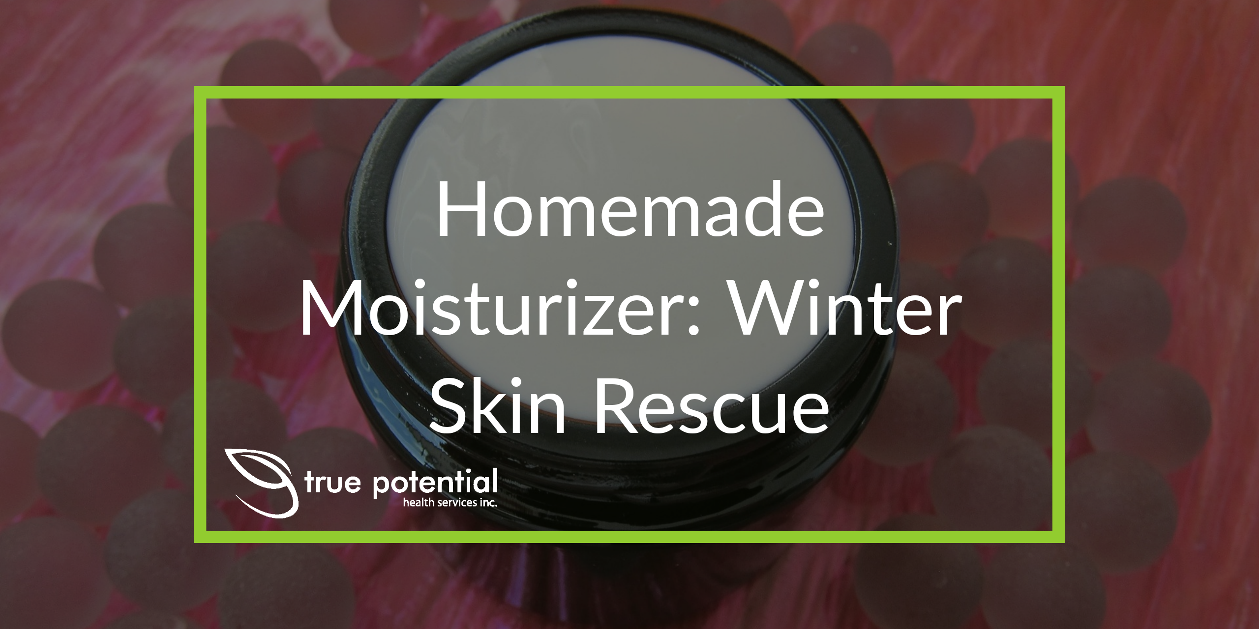 winter skin rescue moisturizer